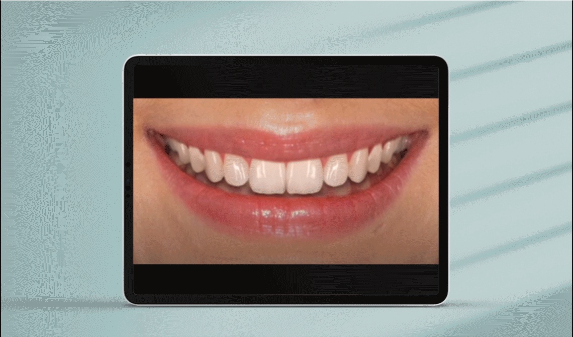 Digital Smile Design - Zobacz jak może wyglądać Twój nowy uśmiech!